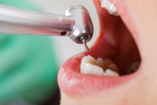 Professional Emergency Dentist in WY